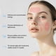 thumbnail image 4 of Máscara facial con luz roja Facego, dispositivo inalámbrico de 7 colores, máscara facial con luz azul y roja para el hogar, silicona suave, ligera y plegable, 4 of 7