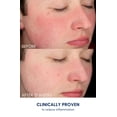 thumbnail image 4 of Bright Girl Day + Bright Facial Moisturizer for Teen Skin, 1.7 oz, 4 of 10