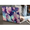 thumbnail image 1 of Plastic Protective Case Hard Cover for 2012 - 2015 Released MacBook Pro 15" No Touch Cable Tie Model: A1398 Marble A 209, 1 of 5