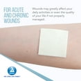 thumbnail image 4 of Dynarex DynaGinate Calcium Alginate Wound Dressing - Sterile, Non-Stick Topical Wound Pads - Absorbent Gel Patches For Moderate To High Exuding Cuts - 2" x 2", 1 Case of 120, 4 of 7