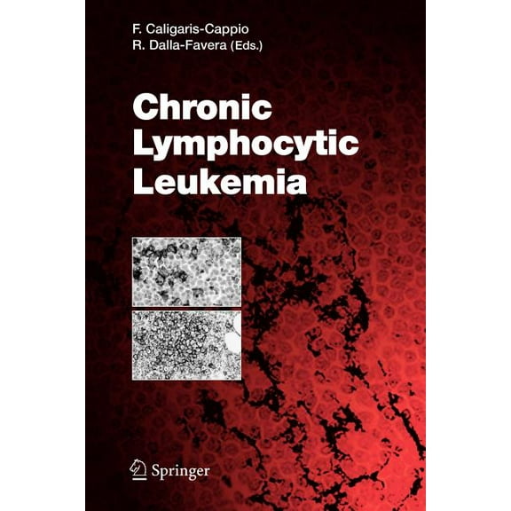 Current Topics in Microbiology and Immmu Chronic Lymphocytic Leukemia, Book 294, (Paperback)