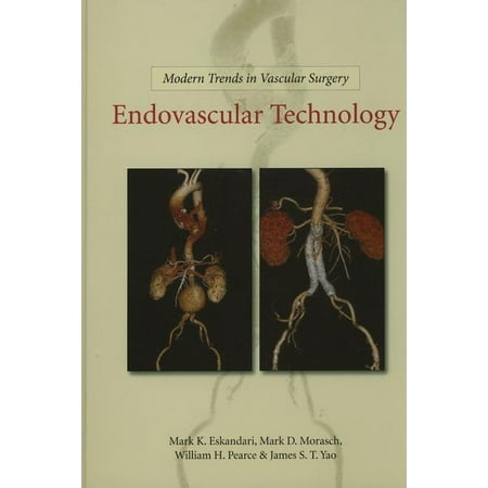 UPC: 9781607950530 | Modern Trends in Vascular Surgery: Modern Trends in Vascular Surgery: Endovascular Technology (Hardcover)