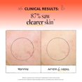 thumbnail image 3 of (Pack Of 3) Derma E Serum Facial Acne Blemish 2 Fl Oz, 3 of 5