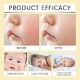 thumbnail image 4 of Ganfancp Niños Cuidado Hidratante Loción Corporal 50G, 4 of 7