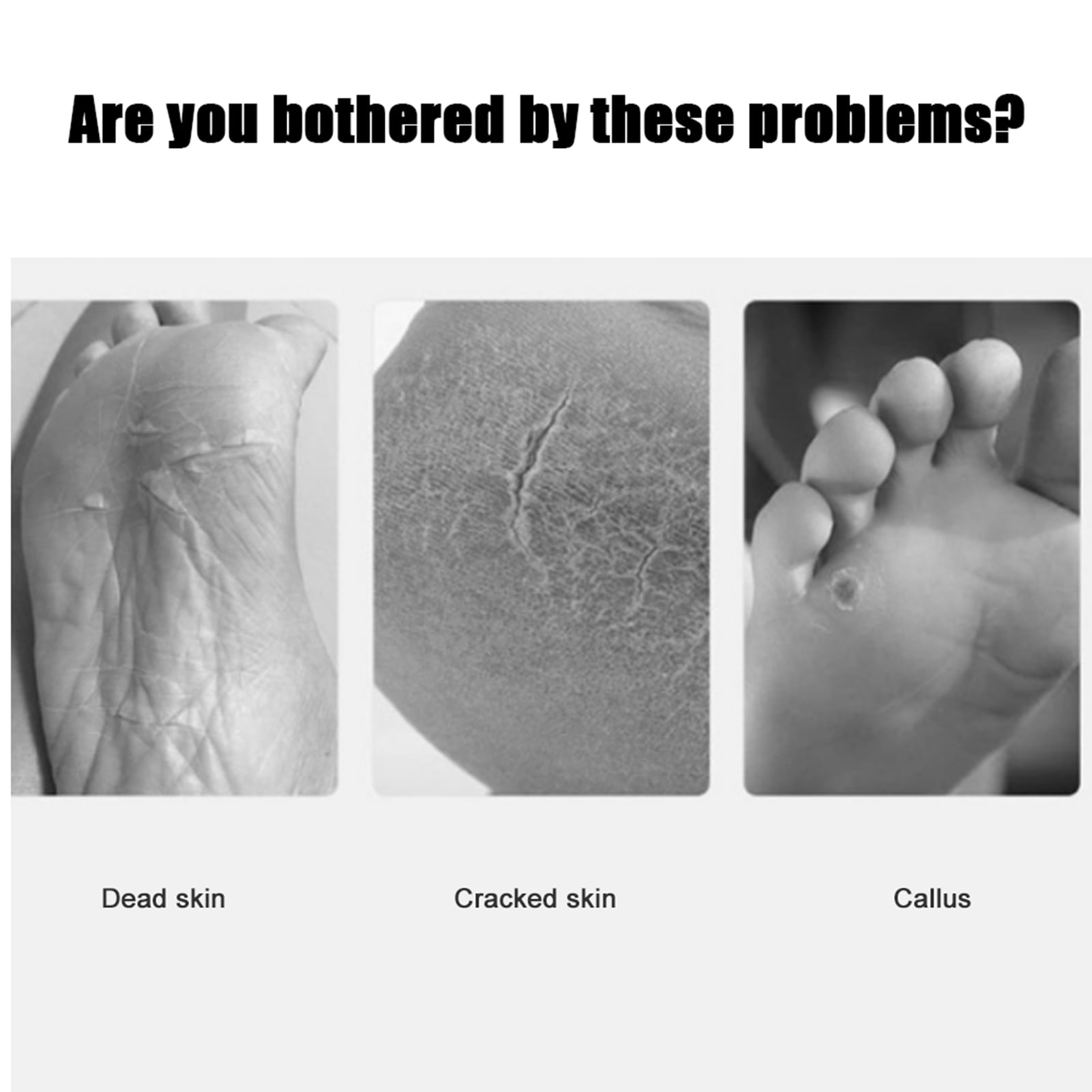 Electric Rechargeable Automatic Callus Remover Foot File Pedicure Tool