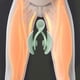 thumbnail image 4 of 2x Entrenador de Cadera Entrenador de Muslo Interno Ejercitador Hombres Rehabilitación Posparto Zulema entrenador de cadera, 4 of 7