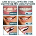 thumbnail image 2 of Denture Teeth Temporary Fake Teeth For Snap On Instant & Confidence Smile, Dental Veneers For Temporary Teeth Restoration RNI, 2 of 5