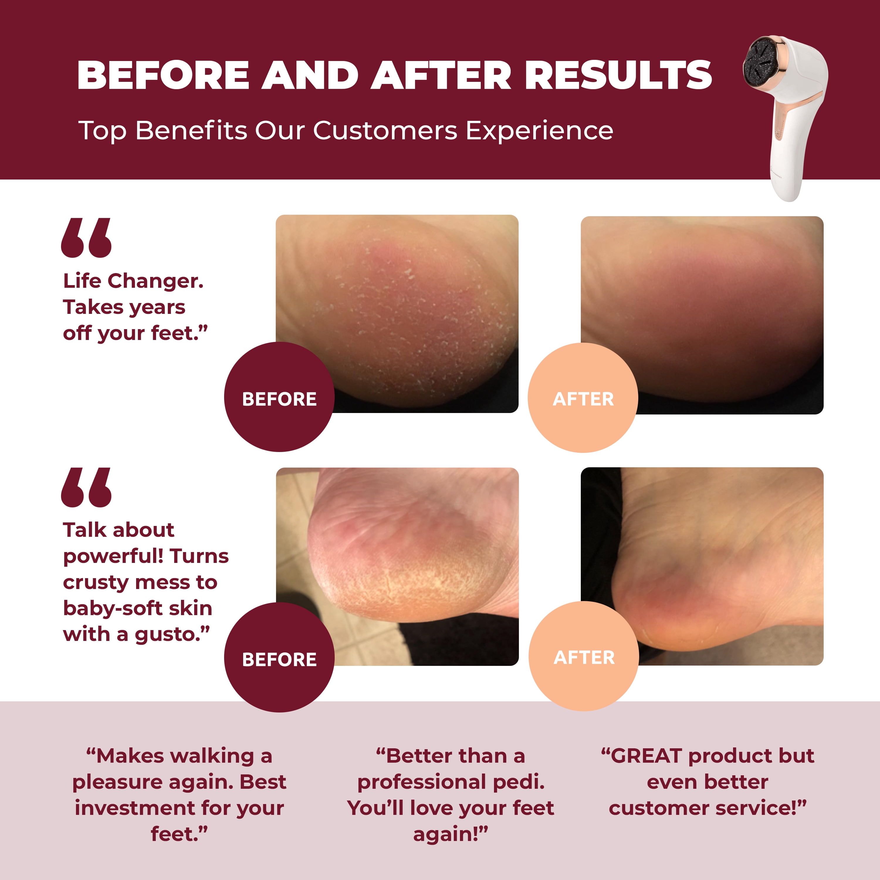 Own Harmony Electric Callus Remover with Vacuum - Foot Care for Women - Professional Pedicure Tools for Powerful Pedi Care Vac - 3 Rollers Electric Feet File CR2100 - Best for Hard Dry, Cracked Heels