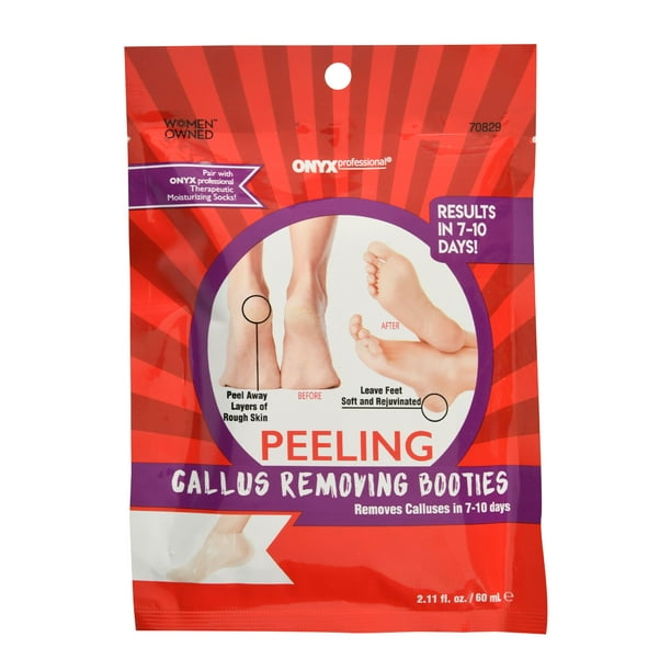 Onyx Professional Extra Strength Peeling Callus Removing Booties