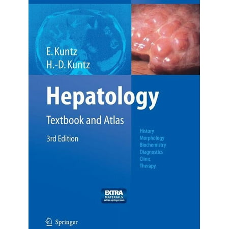 UPC: 9783662499702 | Hepatology: Textbook and Atlas (Paperback)