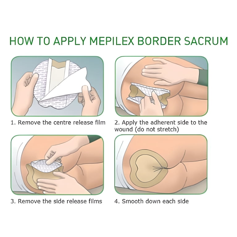 Molnlycke 282000 Mepilex Border Sacrum Adhesive Foam Dressings 7.2x7.2, Bx/5