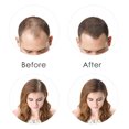 thumbnail image 4 of Fibras capilares BUNEE, 27,5 g, polvo espesante para el cabello, espesante instantáneo, corrector de caída del cabello 100 % natural para hombres y mujeres, 4 of 9