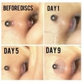 thumbnail image 5 of ZS 9Pcs Silicone Clear Ear Nose Lip Piercing Disc Pad for Piercing Healing Earlobe Support Patches, 5 of 5