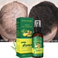 thumbnail image 1 of Aceite esencial para el crecimiento del cabello para hombres y mujeres, suero efectivo de crecimiento rápido, previene la caída del cabello, tratamiento del cuero cabelludo, 5/15/30/50ml, 1 of 3