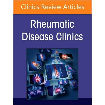 Clinics: Internal Medicine Rheumatic Immune-Related Adverse Events, an Issue of Rheumatic Disease Clinics of North America: Volume 50-2, Book 50, (Hardcover)