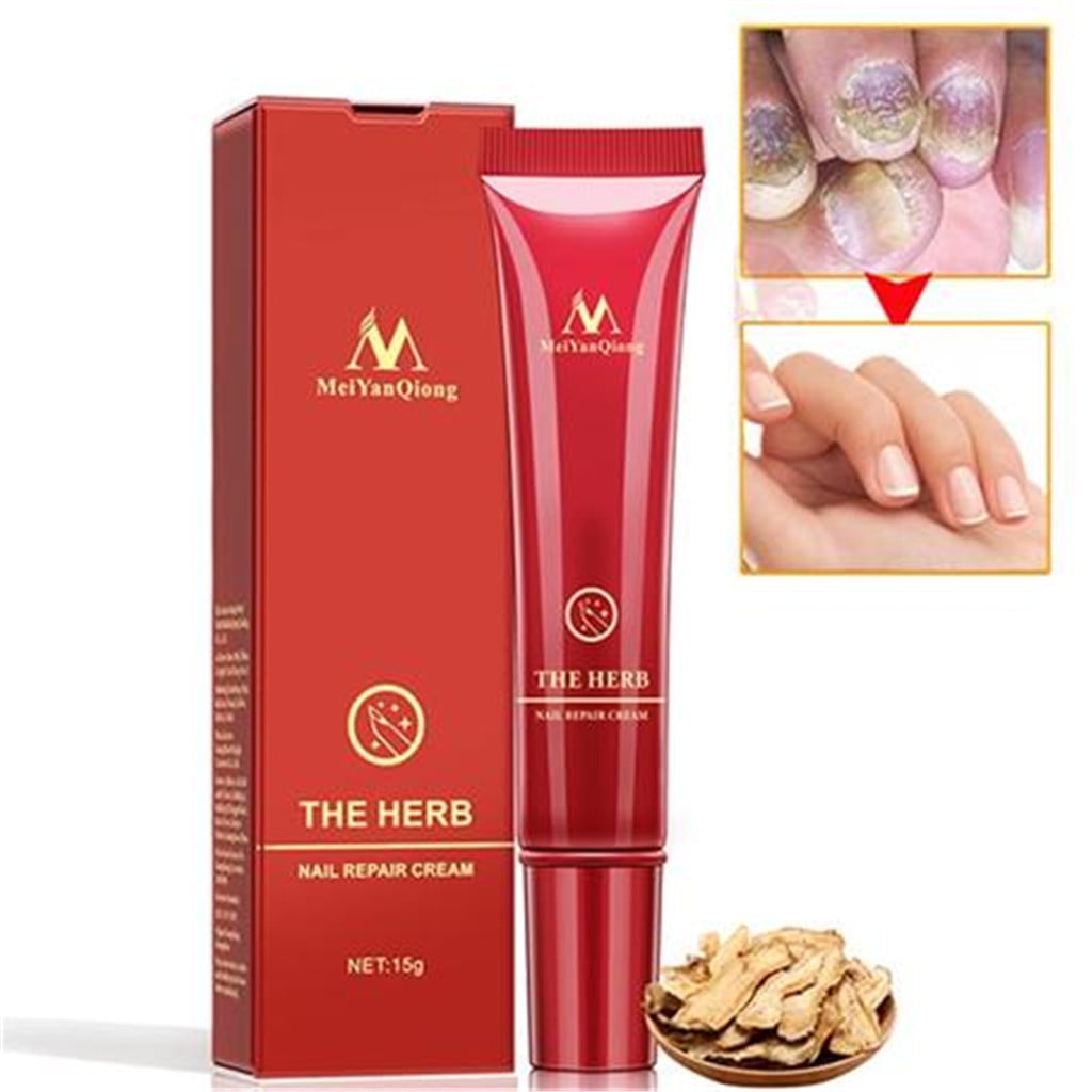 Nail Treatment Cream Prevent Fungal Infections Herb Nail Repair Cream