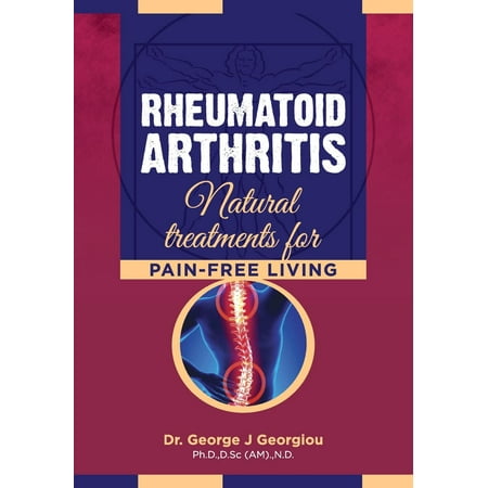 Rheumatoid Arthritis : Natural Treatments for Pain-Free (Best Natural Treatment For Rheumatoid Arthritis)