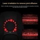 thumbnail image 3 of Masajeador De Rodilla Inteligente Masajeador De Piernas Con Control Táctil Máquina De Masaje Vibratorio Infrarrojo Ajustable Cateissary CE006072-00, 3 of 6