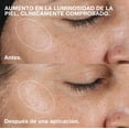thumbnail image 2 of Clinique Clarifying Lotion 2, 200 ml, 2 of 6