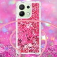 thumbnail image 2 of Funda FOXDOCK para Xiaomi Redmi Note 13 4G con Cuerda Ajustable, Brillo Líquido, Protección Antigolpes y Lente – Ideal para Regalo, 2 of 6