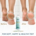thumbnail image 3 of Removedor de callos para pies (fuerza extra) Depurador de pies Gel de callos de piel muerta - Raspador de pies de pedicura profesional Spa Essential, 6 oz, 3 of 5