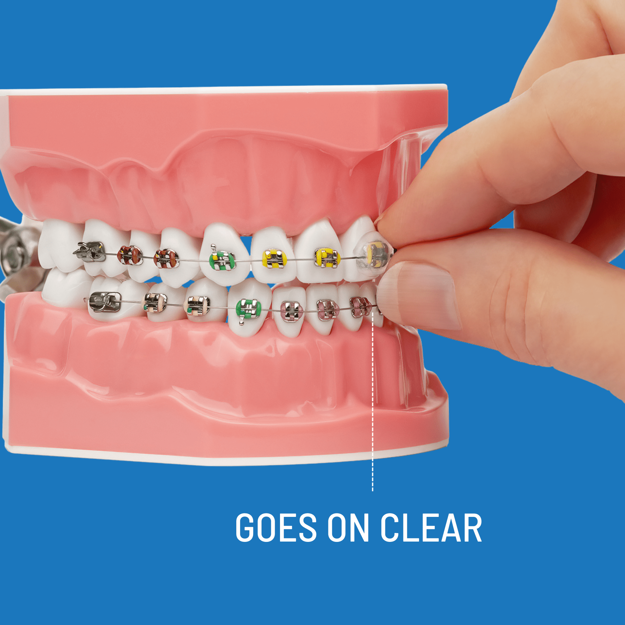 OrthoDots CLEAR -  Braces Wax Alternative for Pain Caused by Braces, Clear Aligner Trays, and Other Orthodontic Appliances - 2 Pack  (24 Count)