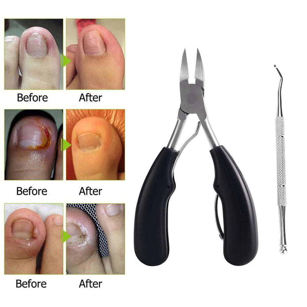 professional toenail clippers best