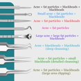 thumbnail image 3 of HPZZ Tweezers,Blackhead, Blackhead Tools, Stainless Steel Blackhead Tweezers, Blackhead Removal Tools, 3 of 6