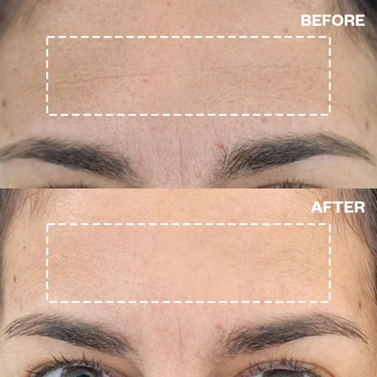 Wrinkles Schminkles Forehead Wrinkle Patches HYZ01 - Reusable