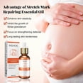 thumbnail image 4 of Skin repair essential oil pregnant women's skin stretch mark skin care essence, 4 of 5