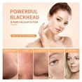thumbnail image 2 of XIRQI Pore Vacuum,Usb Rechargeable Blackhead Remover Vacuum,3 Levels Adjustable Pore Vacuum Blackhead Remover,With 5 Suction Power,6 Probes,Face Vacuum Pore Cleanser for Women And Men (White), 2 of 7
