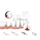 thumbnail image 2 of Tooth Polisher Electric Toothbrush Beauty Tooth Meter Electric Dental Cleaner Adult Toothbrush Teeth Cleaning Smoke Stains Dental Plaque, 2 of 3