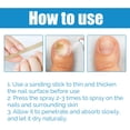 thumbnail image 5 of Anti-Fungal Disinfectant Spray for Nail Fungus Removal, Fast-Acting Solution, Eliminates Odor, 100ml Bottle, Safe for Daily Use, 5 of 8