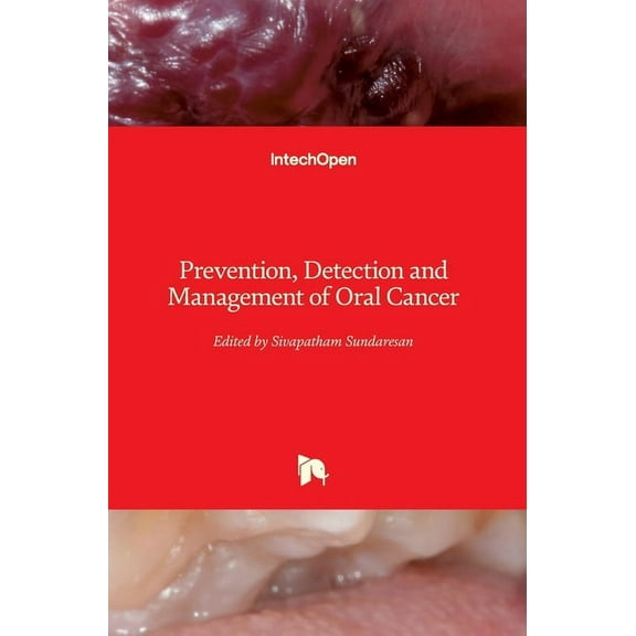 Prevention, Detection And Management Of Oral Cancer