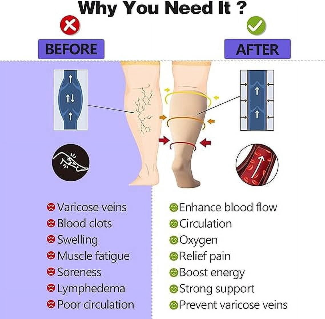 Wukang Open Toe Sheer Compression Stockings for Women, 15-20 mmHg Knee High Circulation Support Stockings, Graduated Medical Compression Socks for Travel, Flight
