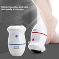 thumbnail image 4 of Electric Foot Callus Remover with 2 Grinding Heads USB Rechargeable Foot File Hard Skin Remover Portable Foot Scrubber, 4 of 8