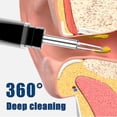 thumbnail image 4 of Removedor de cera de oído inteligente con luces, cámara Wifi, endoscopio de oído inalámbrico de alta definición, cuchara para recoger, otoscopio de limpieza, 4 of 5