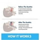 thumbnail image 4 of 2025 New Honex Anti-Snoring Mouthpiece, Quiet Anti-Snoring Device at Night, Unisex Mouthguard, Soft and Comfortable, 4 of 5