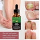 thumbnail image 2 of Multi-Purpose Ginger Infused Nail Repair Solution for Daily Use, 2 of 5