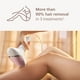 thumbnail image 3 of Depiladora Philips Lumea 8000 IPL BRI932/03, 3 of 9