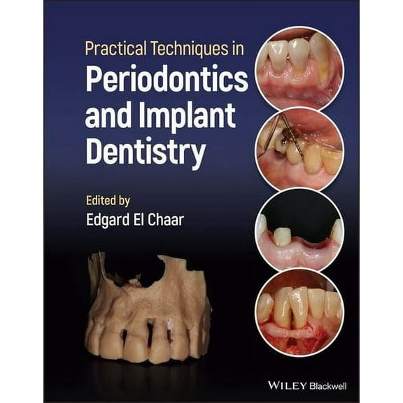 Practical Techniques in Periodontics and Implant Dentistry (Hardcover)