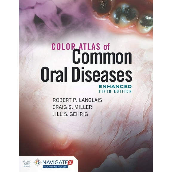 Color Atlas of Common Oral Diseases, Enhanced Edition, (Paperback)