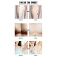 thumbnail image 4 of Painless Physical Hair Removal Epilator Depilation Exfoliating Tool Easy to Use, 4 of 8