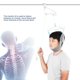 thumbnail image 3 of Fijación de tracción Soporte Tracción del cuello ajustable cervical Corrección de cuello de diente Camilla de alivio del dolor dispositivo de tracción del cuello, mentoniera para tracción Ecomeon no, 3 of 6
