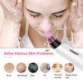 thumbnail image 6 of BESTOPE Blackhead Remover Vacuum, Skin Vacuum Pore Cleaner Blackhead Removal Tool Electric Acne Comedone Suction Device with IPL Beauty Lamp 4 Blackhead Extractor Tool for All Facial Skin Treatment, 6 of 8