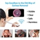 thumbnail image 2 of 1 Pack Ear Wax Removal, Ear Cleaner, Otoscope, Earwax Remover Tools, Scope, With 1080p Fhd Camera, 6 Led Lights, Wireless Connected, Compatible With I, 2 of 5