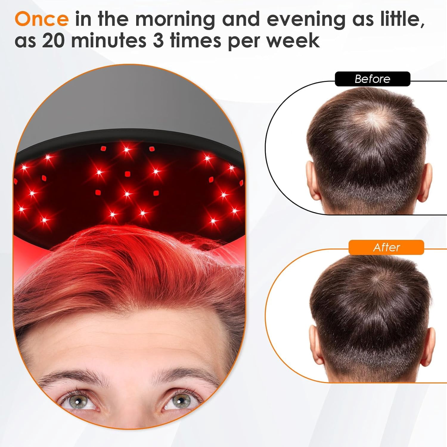 Wearable Scalp Care Helmet with Red & Infrared Light, Hands-Free Light Device with Adjustable Fit for At-Home Hair Wellness Routines, Portable & Rechargeable