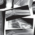 thumbnail image 4 of Roylco Broken Bones X-Rays – Human Skeletal Fracture X-Ray Set for STEM/STEAM Anatomy Lessons, Light Table Viewing & Hands-On Science Learning, 4 of 5