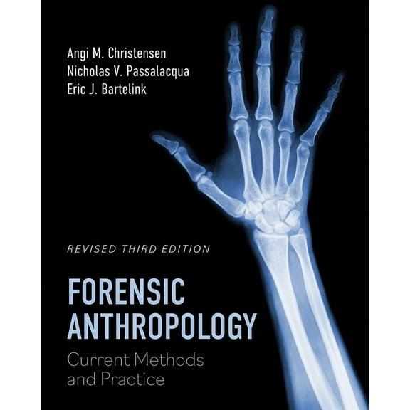 Forensic Anthropology: Current Methods and Practice, (Paperback)