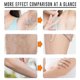 thumbnail image 4 of Jaysuing Hair Removal Spray Foam Cleansing Care Underarm Leg Hair Smooth And Delicate Gentle Hair Removal Spray - 30ML, 4 of 5